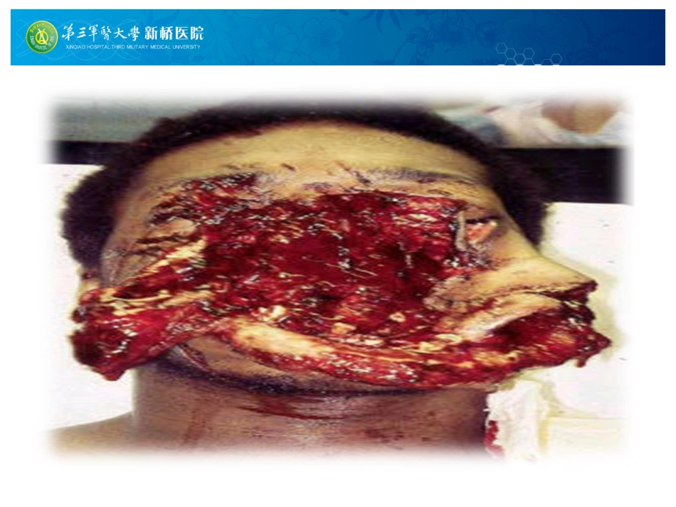 急诊气道管理策略_第3页