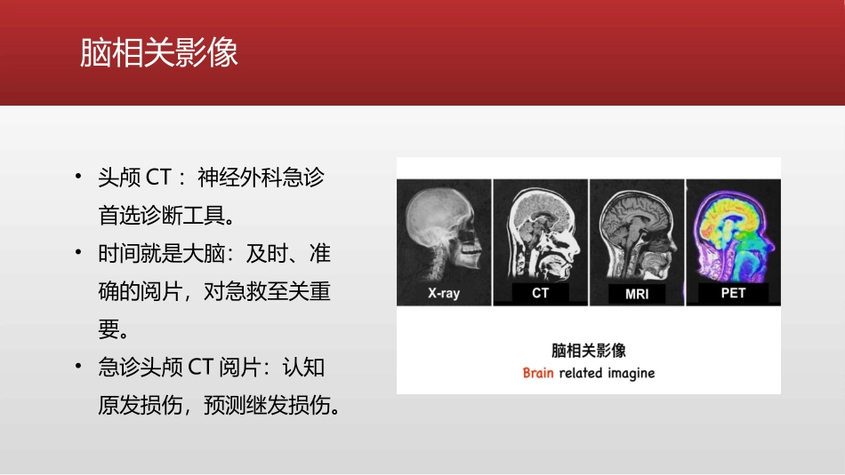 急诊头颅CT阅读法_第2页