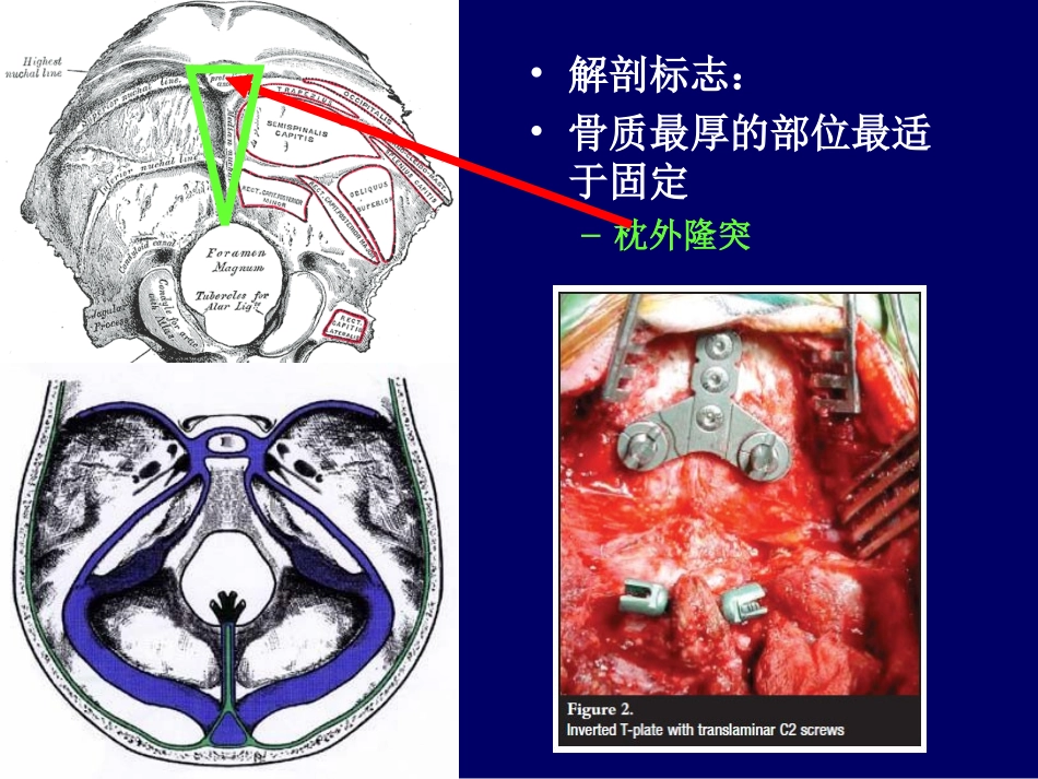 脊柱内固定应用解剖_第3页