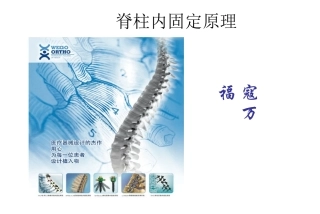 脊柱内固定原理