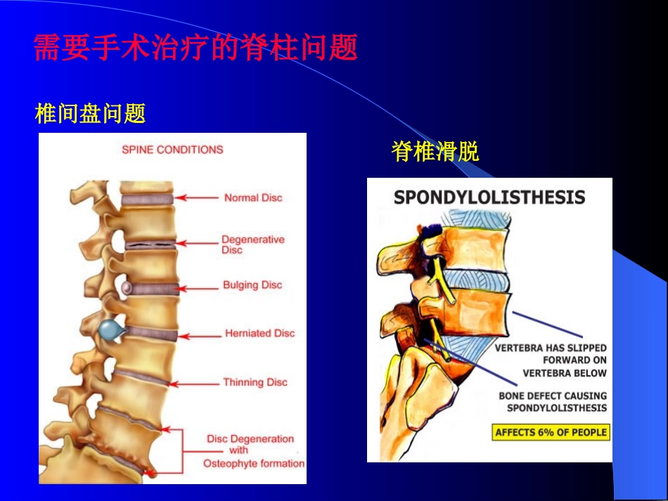 脊柱手术麻醉知识_第2页