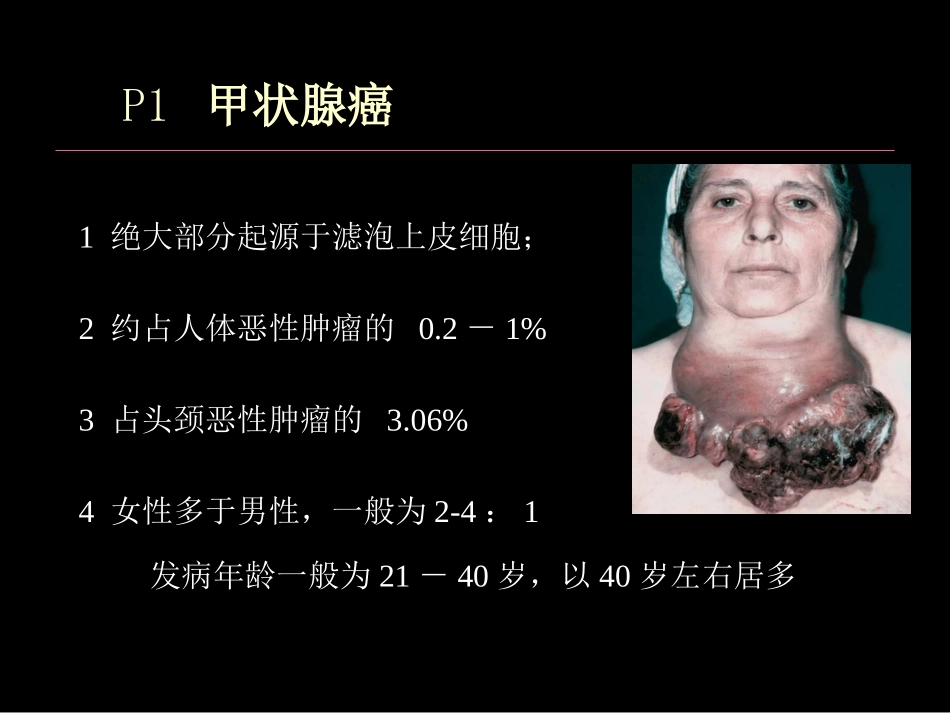 甲状腺癌PBL研究_第3页