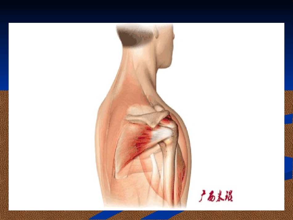 肩袖损伤核磁诊疗_第3页