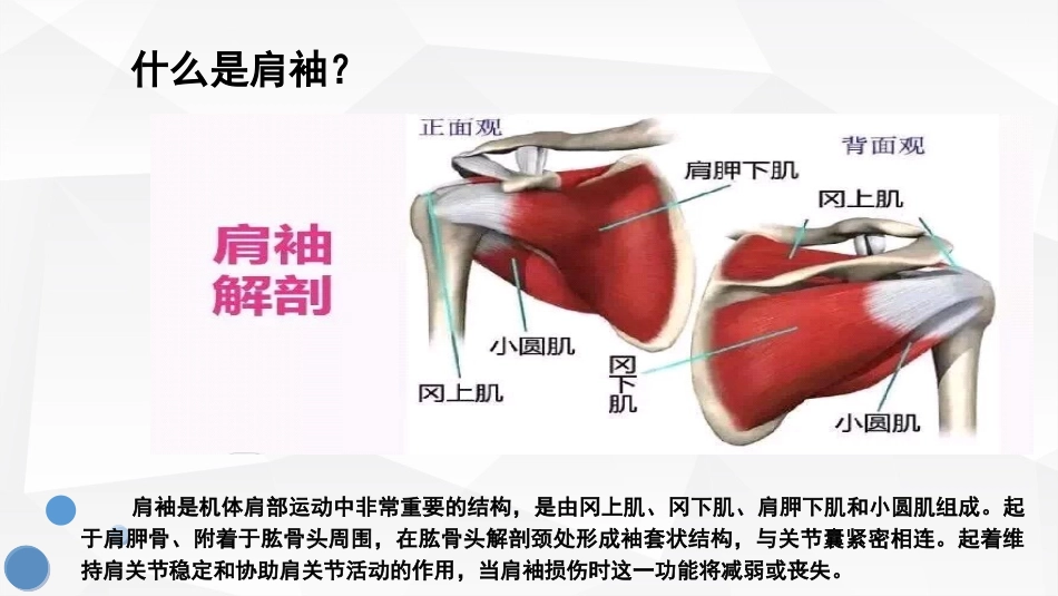 肩袖损伤护理查房_第2页
