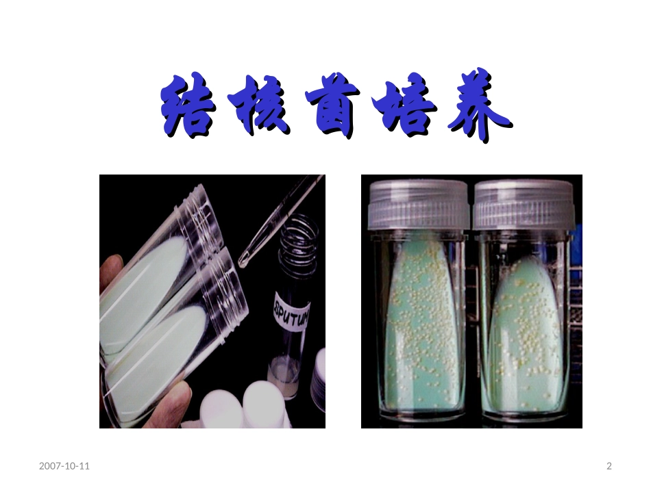 结核分枝杆菌培养药敏实验及质量控制_第2页