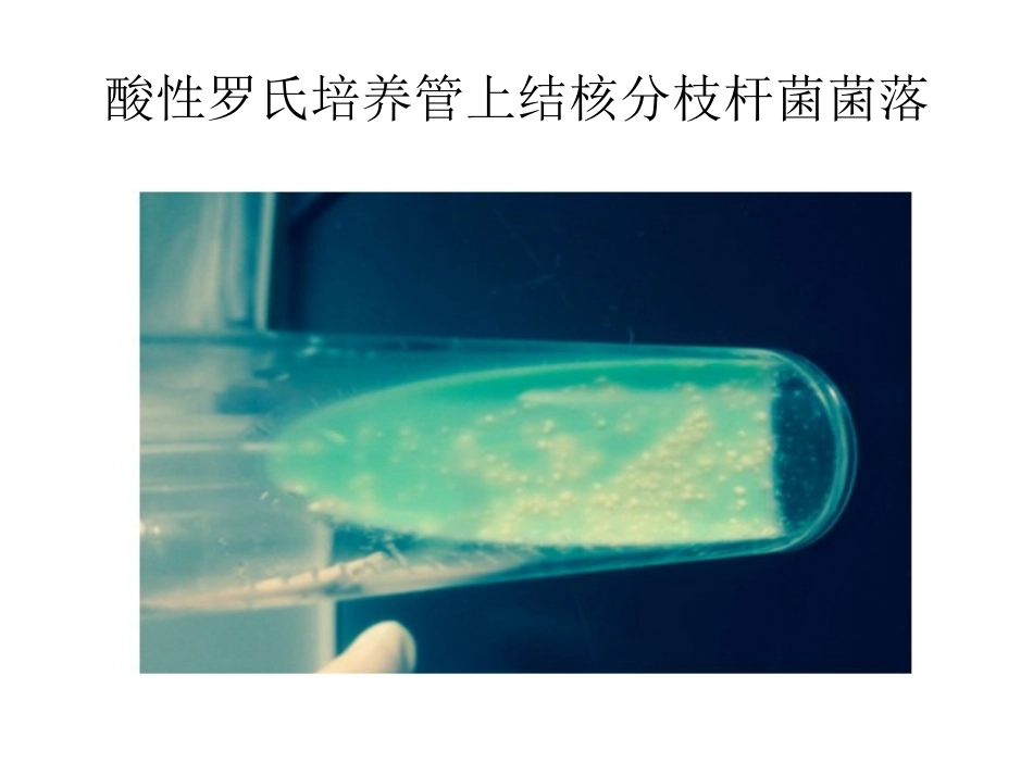 结核分枝杆菌培养药敏实验及质量控制_第3页