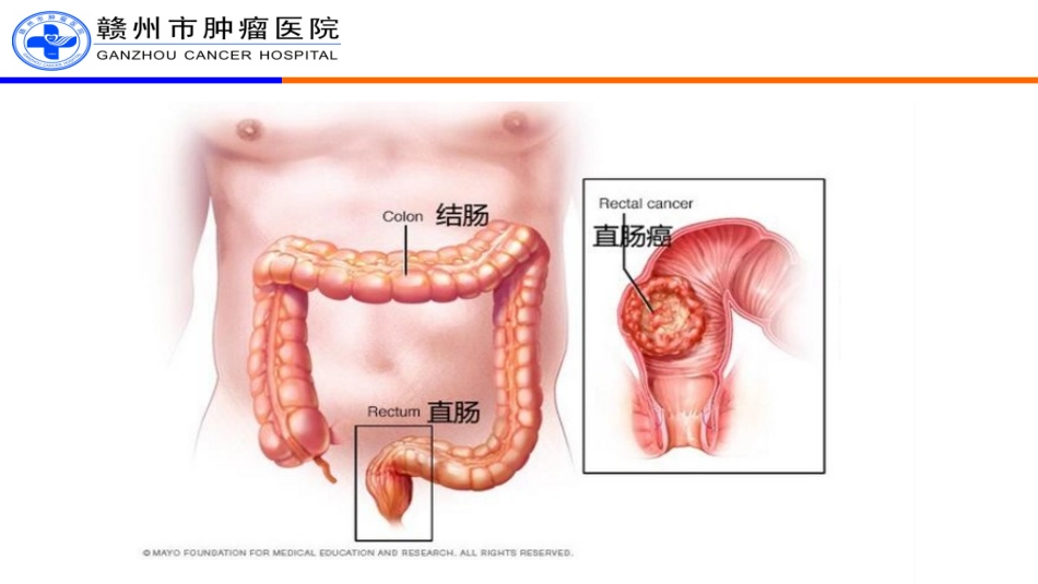 结直肠癌病理诊疗规范_第2页