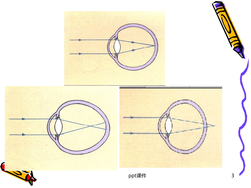 近视的预防课件_第3页