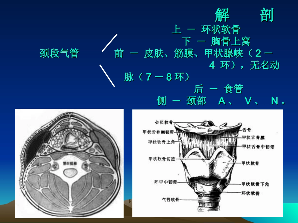 经皮式气管切开术_第3页