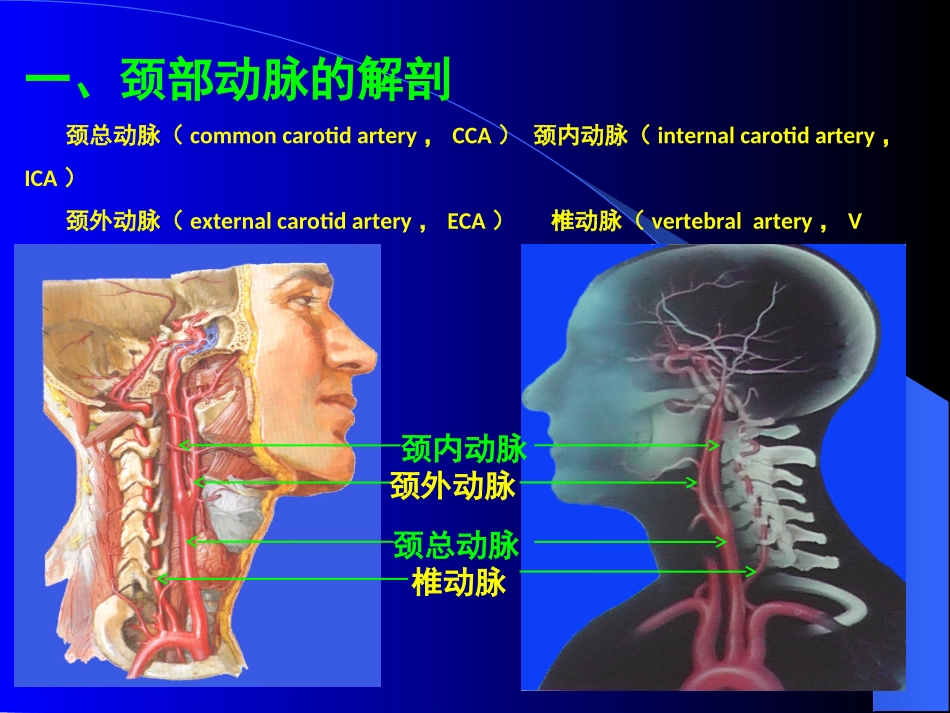 颈部动脉的超声诊疗_第3页