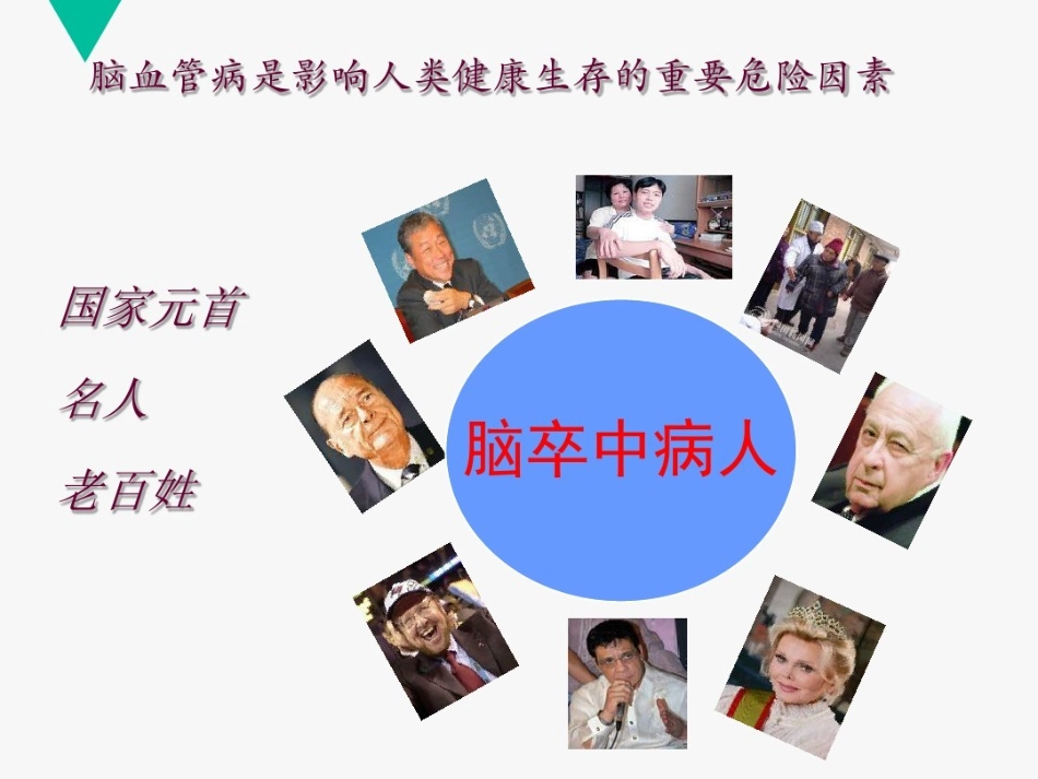 颈动脉狭窄的危害及治疗_第2页