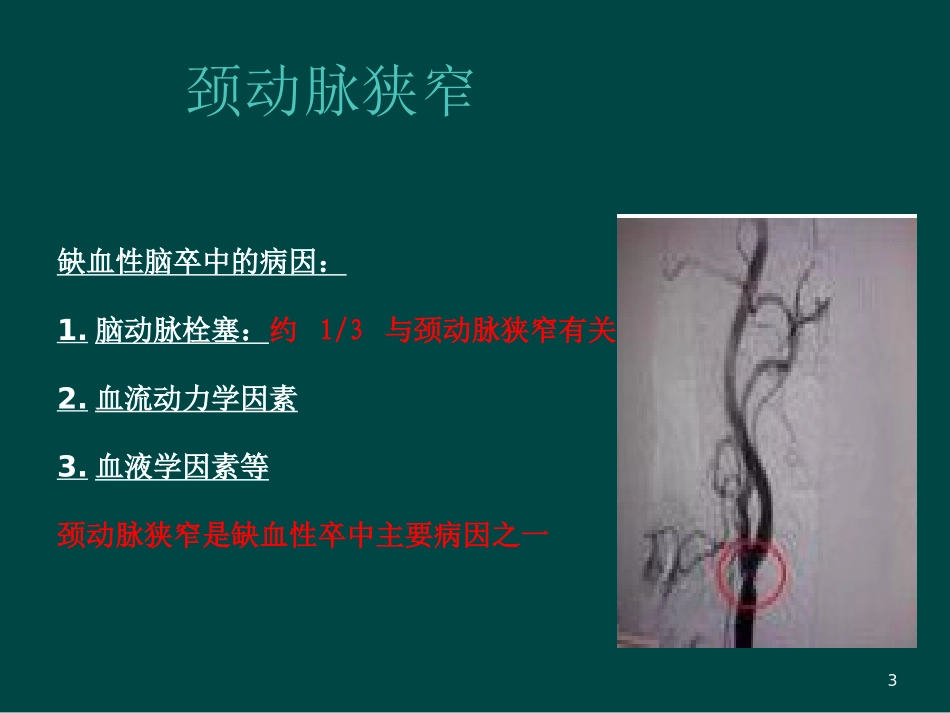 颈动脉支架植入护理查房_第3页