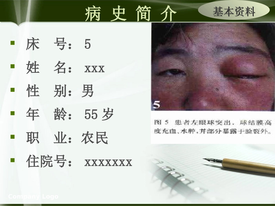 颈内动脉海绵窦瘘护理查房_第3页