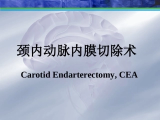 颈内动脉内膜切除术