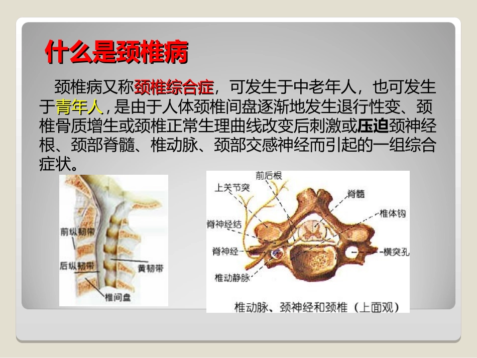 颈椎病的预防和保健课件_第2页
