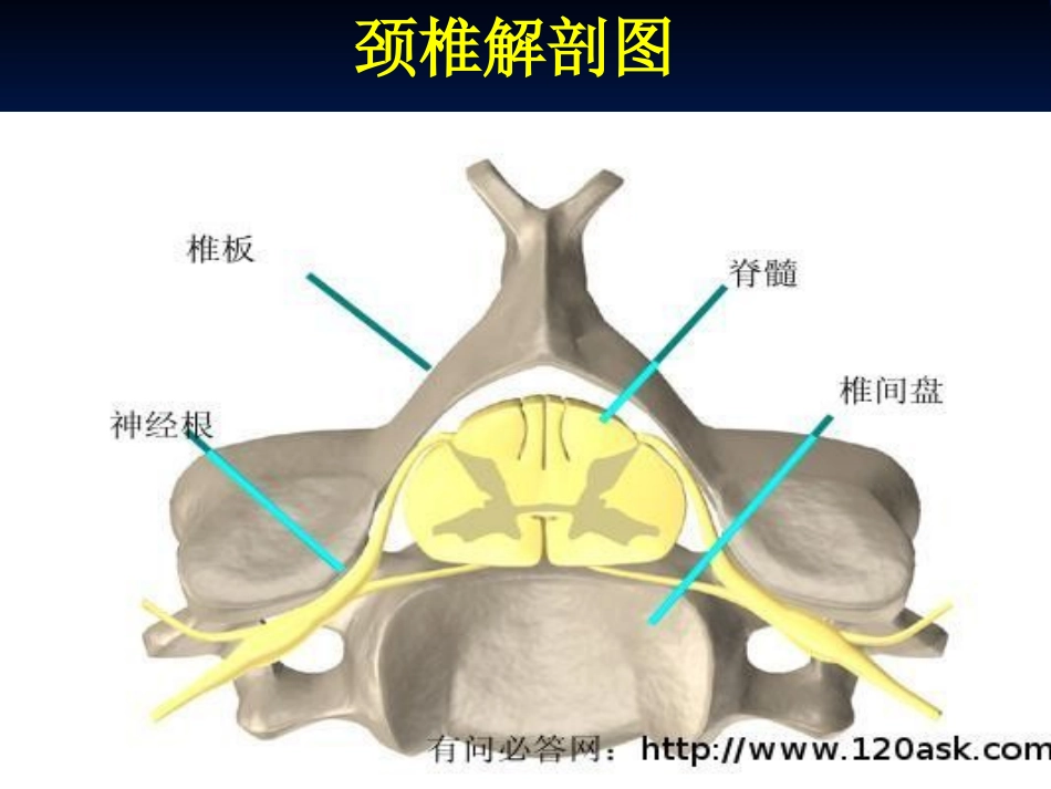 颈椎病围手术期护理_第3页