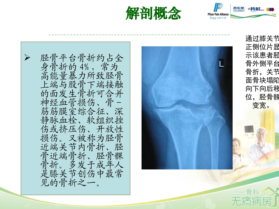胫骨平台骨折的护理_第3页