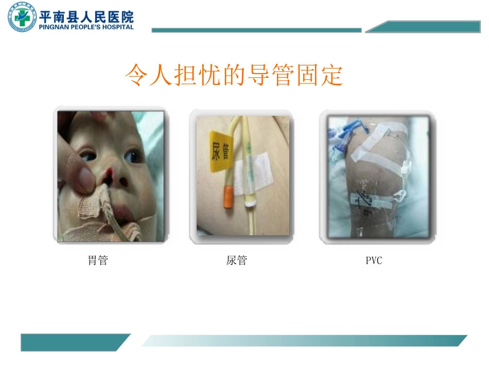 静疗培训常见各种导管的固定方法_第2页