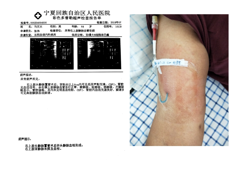 静脉血栓栓塞症的预防及处置_第3页