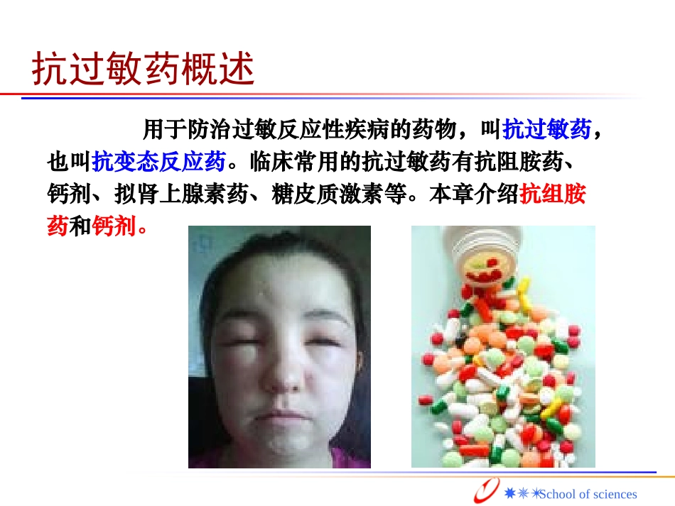 抗过敏药课件_第2页