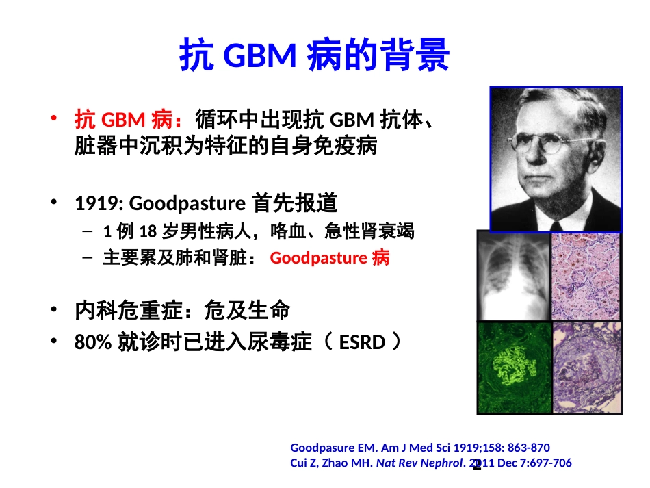 抗肾小球基底膜GBM病_第2页