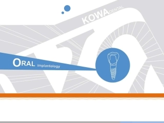 口腔种植牙知识
