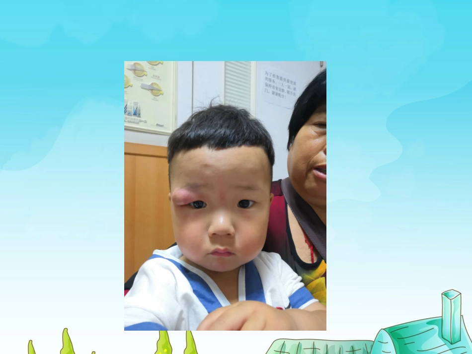 眶蜂窝织炎护理查房_第2页