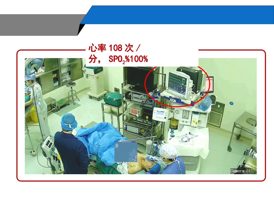 困难气道的识别_第2页