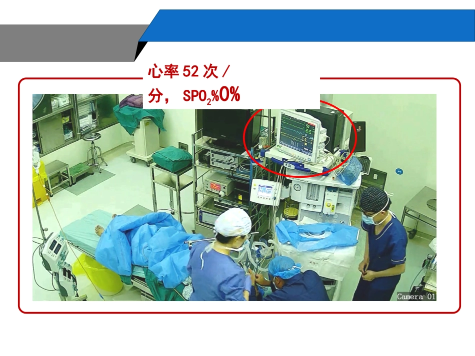 困难气道的识别_第3页
