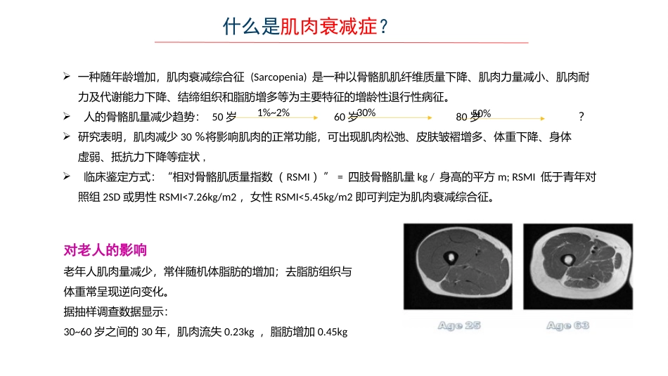 老年肌肉衰减症讲解_第2页
