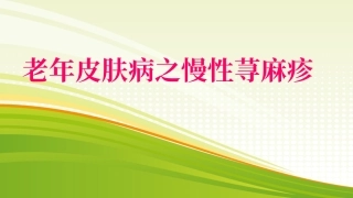 老年皮肤病之慢性荨麻疹