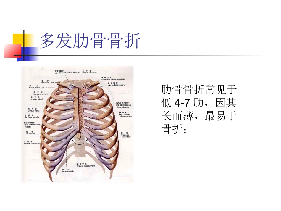 肋骨骨折合并血气胸的护理_第2页
