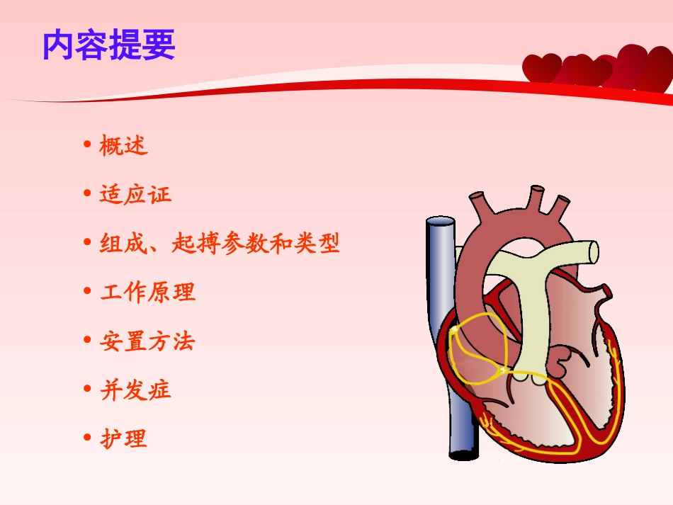 临时起搏器护理_第2页