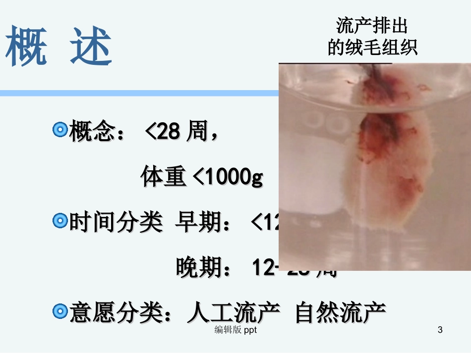 流产的护理最新课件_第3页