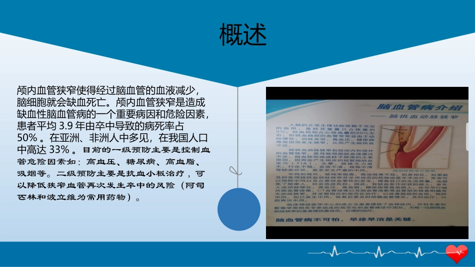 颅内动脉狭窄护理_第3页