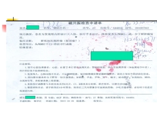 颅内孤立性纤维瘤MRI表现