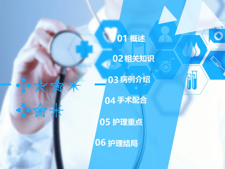 面肌痉挛手术_第2页