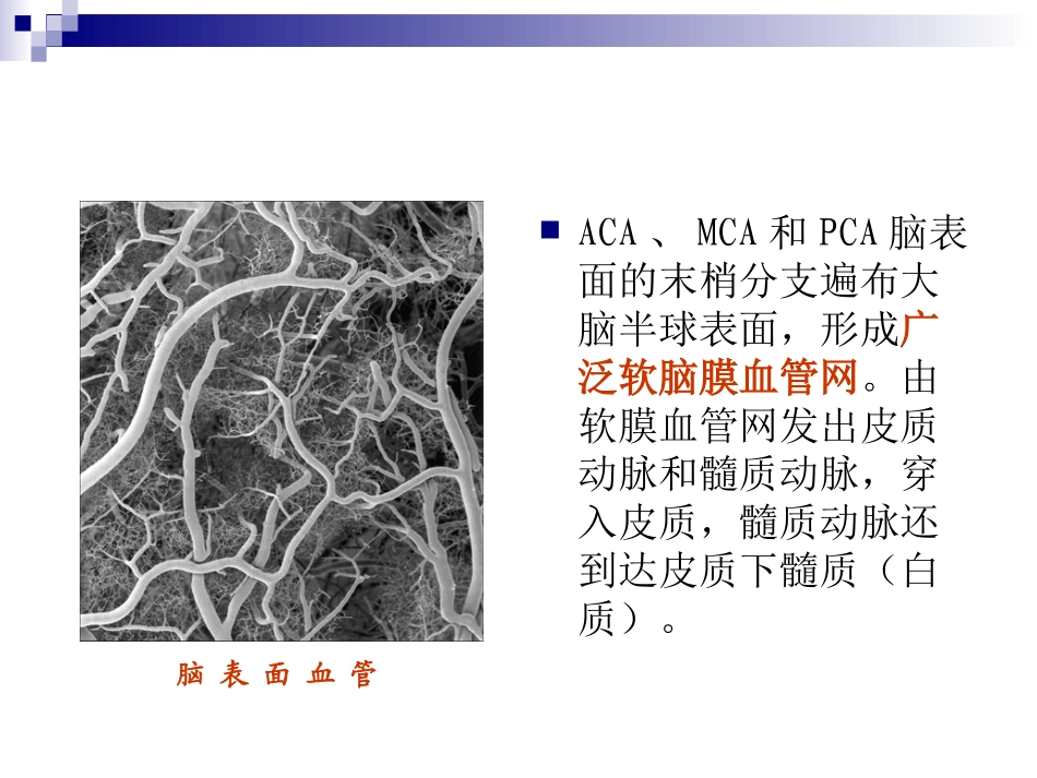 脑分水岭梗死_第3页