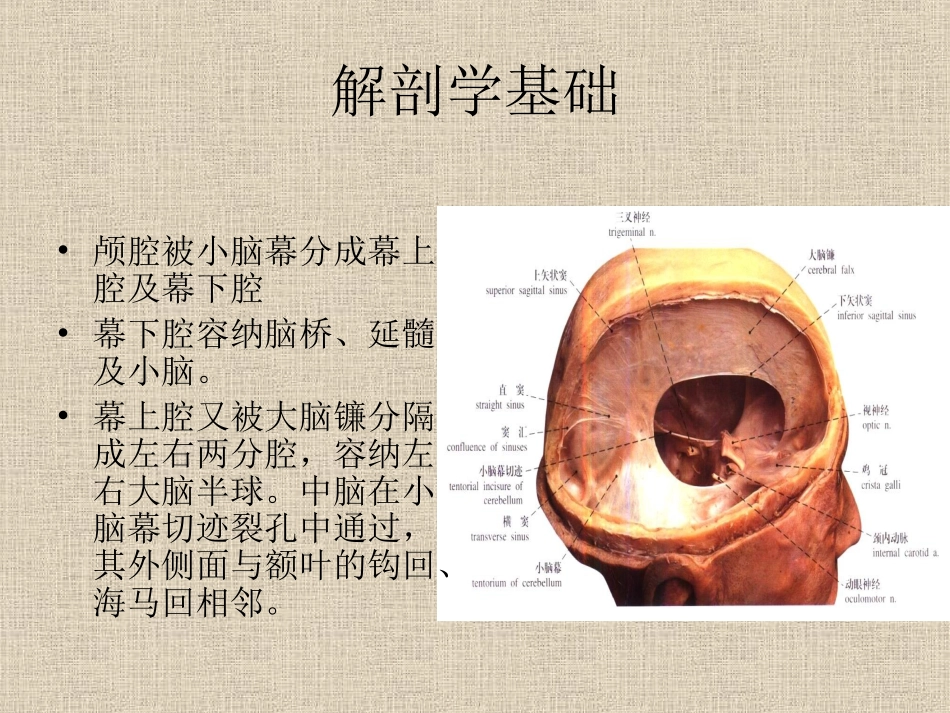 脑疝影像表现_第2页