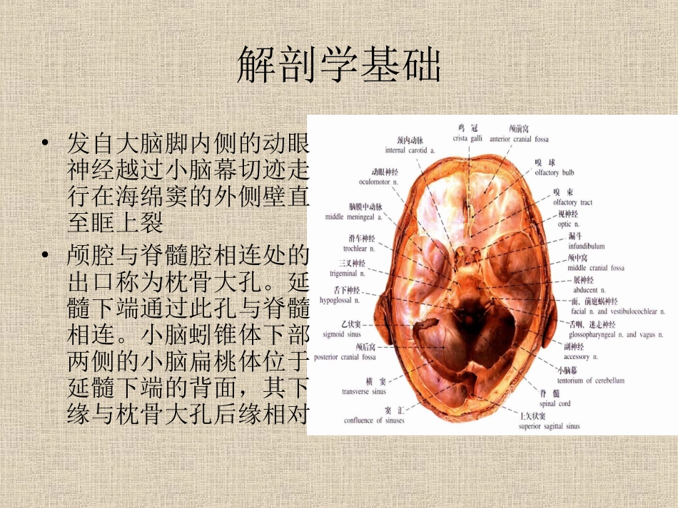 脑疝影像表现_第3页