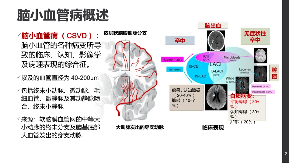 脑小血管病和头晕及平衡障碍_第2页