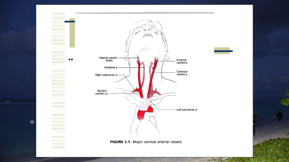 脑血管DSA阅片_第2页