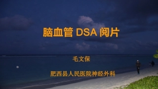 脑血管DSA阅片