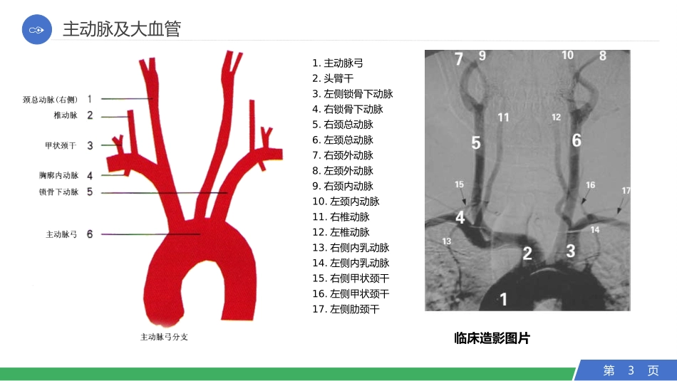 脑血管解刨及神经介入手术_第3页