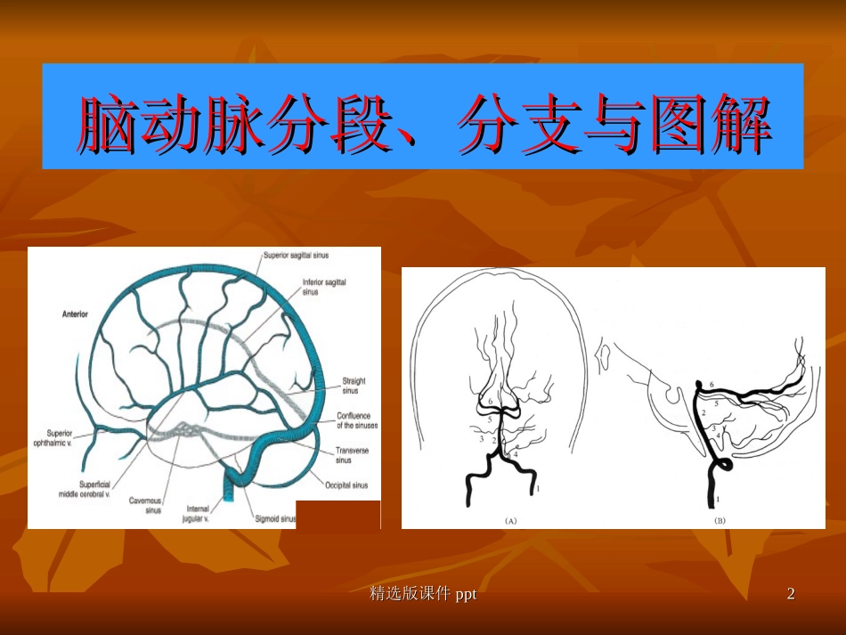 脑血管解剖图解_第2页