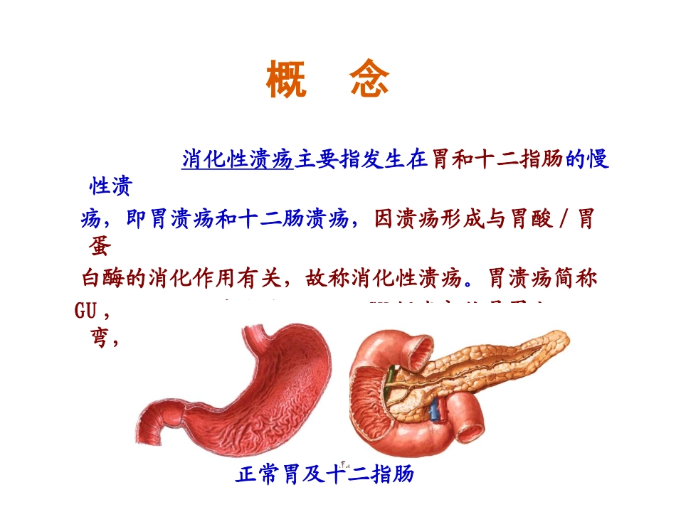 内科护理.学消化性溃疡病人的.护理_第2页