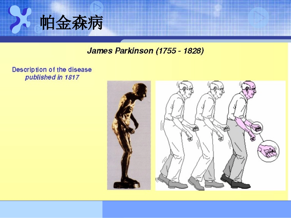 帕金森病的辅助检查血_第3页