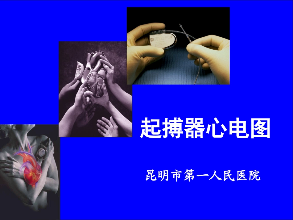 起搏器心电图资料_第1页