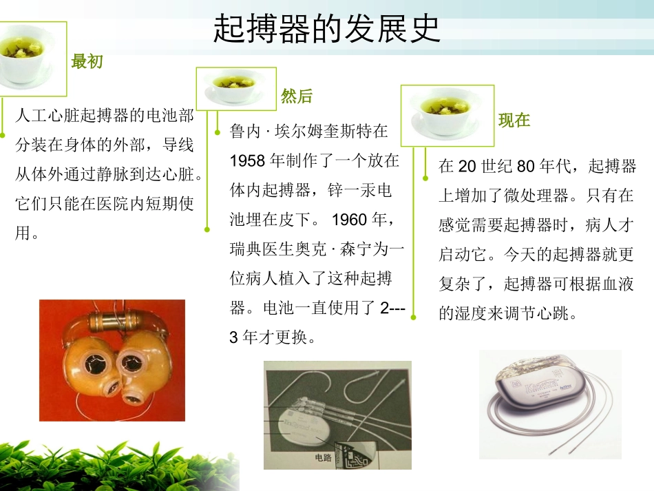 起搏器植入病人护理_第3页