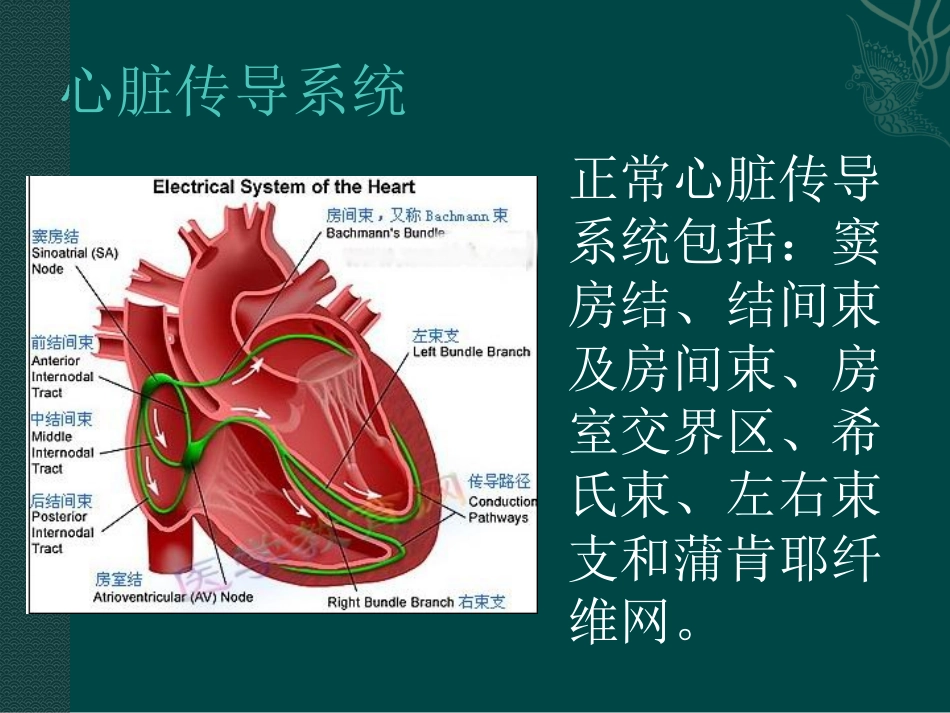起搏器植入术后病人的护理_第3页